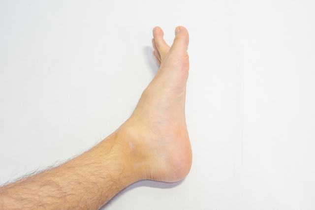 足裏の痛み│足底腱膜炎